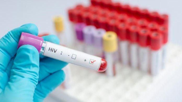 HIV/AIDS