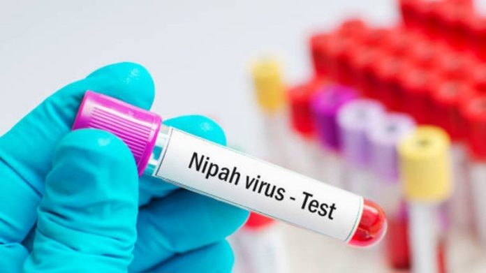 Virus nipah